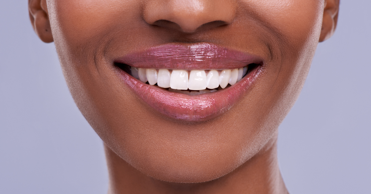 Black woman smiling because of seo for cosmetic dentists