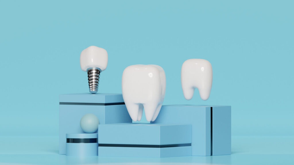 Dental Implant Marketing