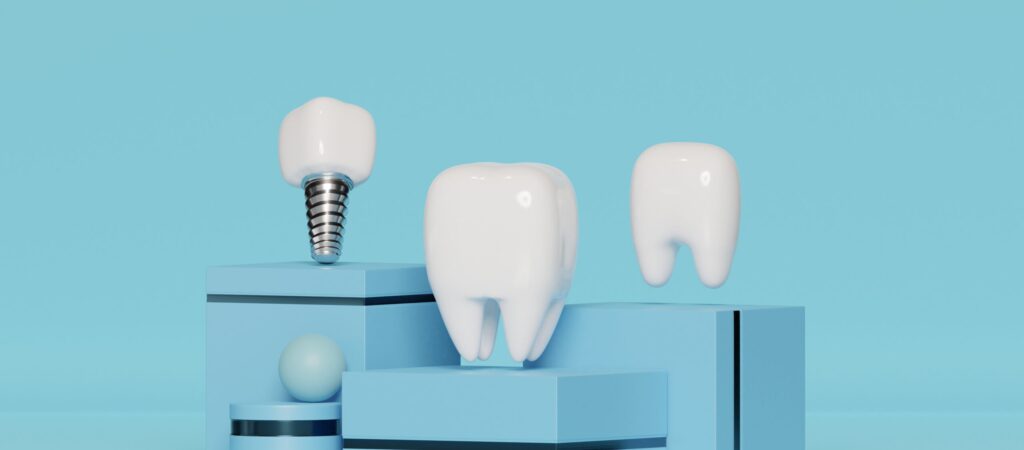 Dental Implant Marketing